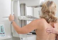 Mammografia w Nowej Soli za darmo w weekend! Można badać się też w poniedziałek