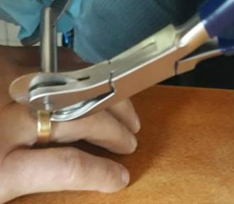 Jastrzębie: strażacy pomagali mężczyźnie, któremu na palcu utknęła obrączka