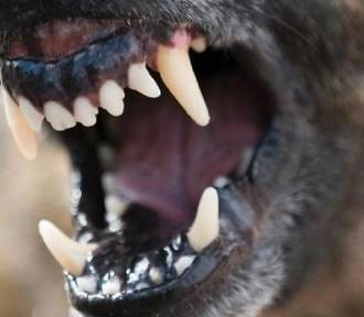 Jastrzębie: Agresywny pies zaatakował 14-latka