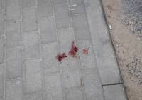 Atak nożownika w pow. żnińskim. Mężczyzna został raniony w szyję. Trwają poszukiwania