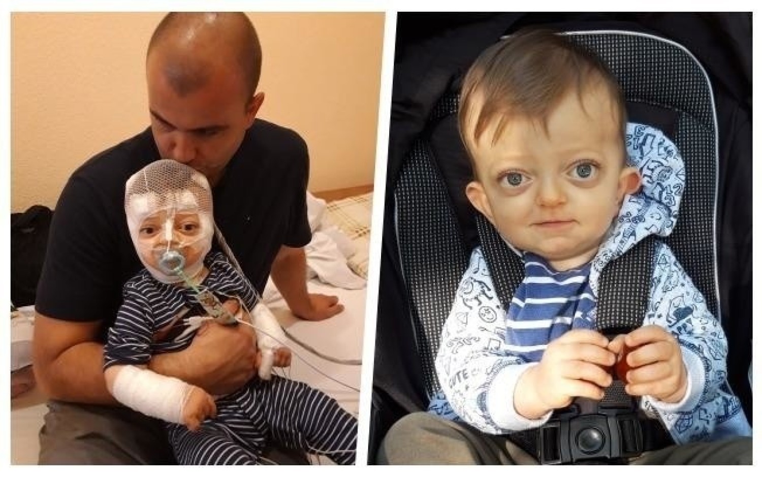 Adaś Kos potrzebuje nadal kosztownego leczenia, dlatego każda pomoc się przyda