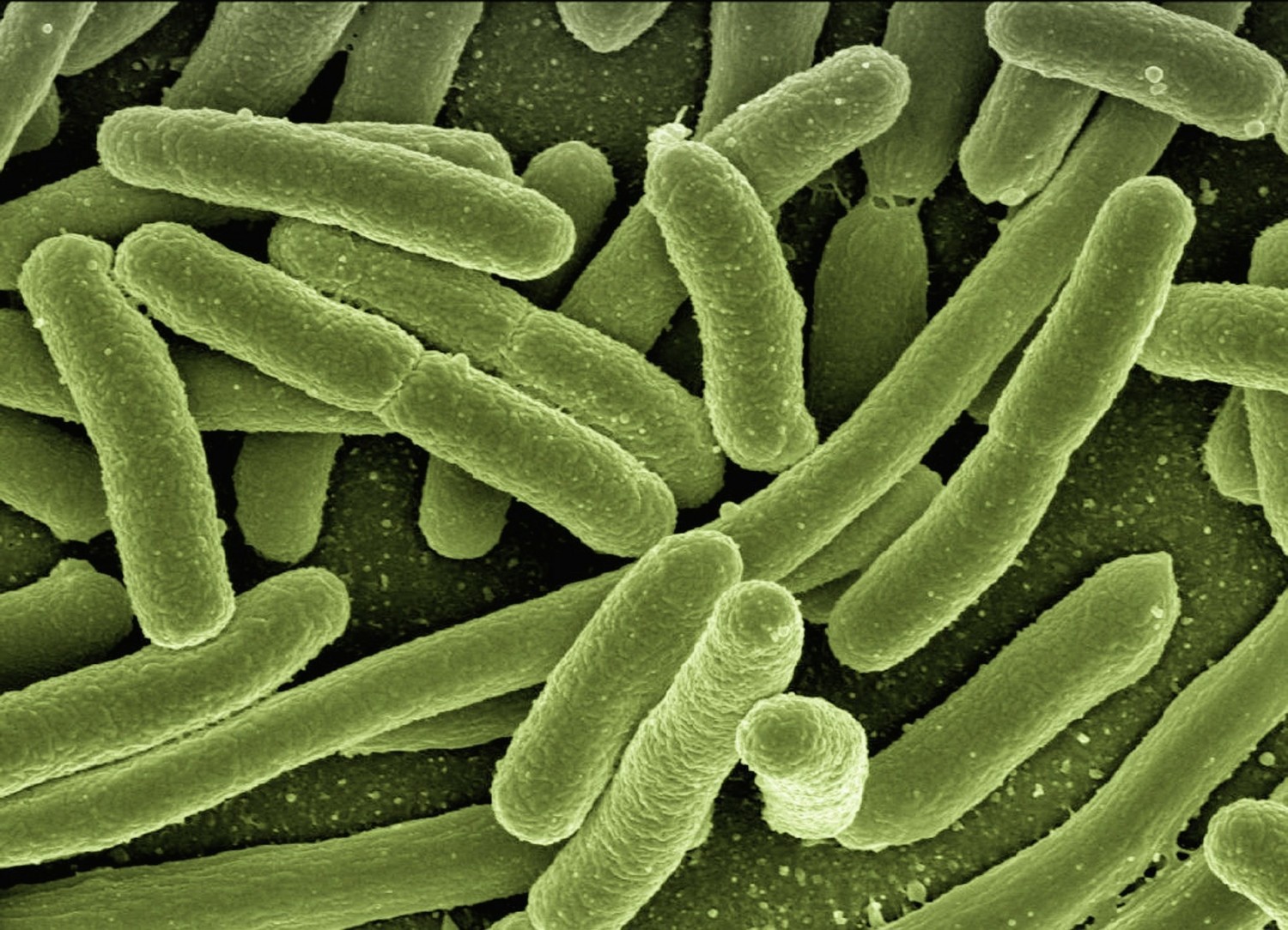 Bakterie E. coli