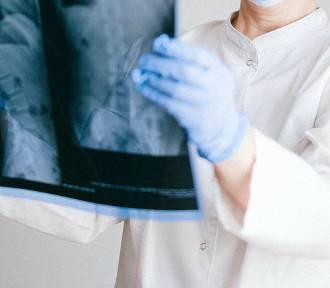 Mieszkańcy Krosna mogą zapisać się na bezpłatne badania wykrywające osteoporozę