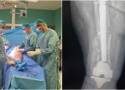 Lekarze ze szpitala Szczeklika w Tarnowie uratowali pacjentkę przed amputacją nogi. Sukces skomplikowanej operacji ortopedycznej. Zdjęcia