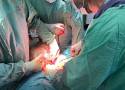W kaliskim szpitalu usunięto wielki guz jajnika. Lekarze przypominają o badaniach profilaktycznych. ZDJĘCIA