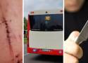 Przerażająca sytuacja w autobusie w Katowicach! Pijany zaatakował nożem nastolatka wracającego ze szkoły, chłopak ma 43 szwy na twarzy