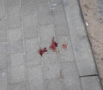 Atak nożownika pod Żninem. Mężczyzna raniony w szyję. Trwają poszukiwania