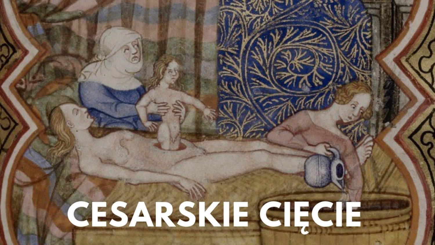 Cesarskie cięcie