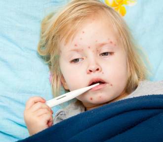 Epidemia odry w Warszawie. Jak się chronić? Jakie są objawy odry?