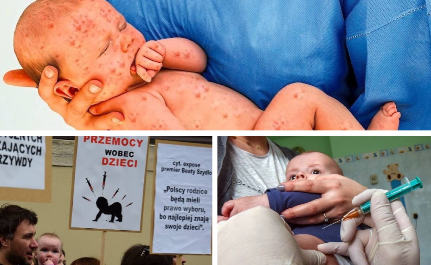 Bez szczepień nie przyjmą dziecka do przedszkola?