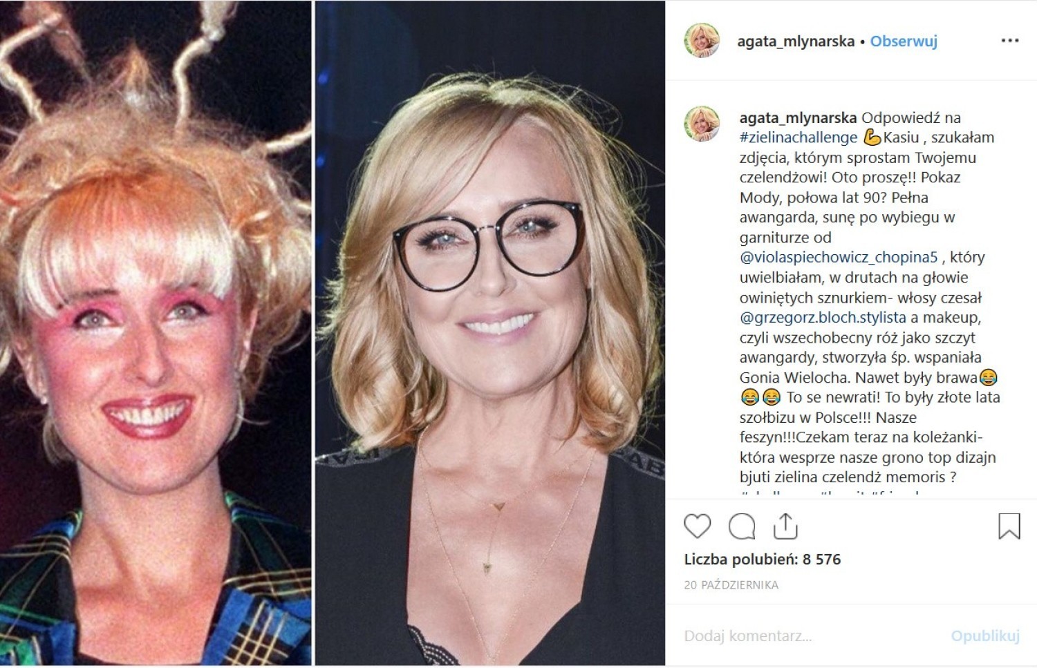 Zobacz niesamowite metamorfozy gwiazd i kompromitujące zdjęcia