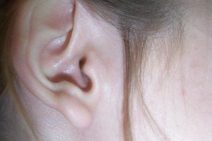 Jak nazywają się trzy kosteczki słuchowe?